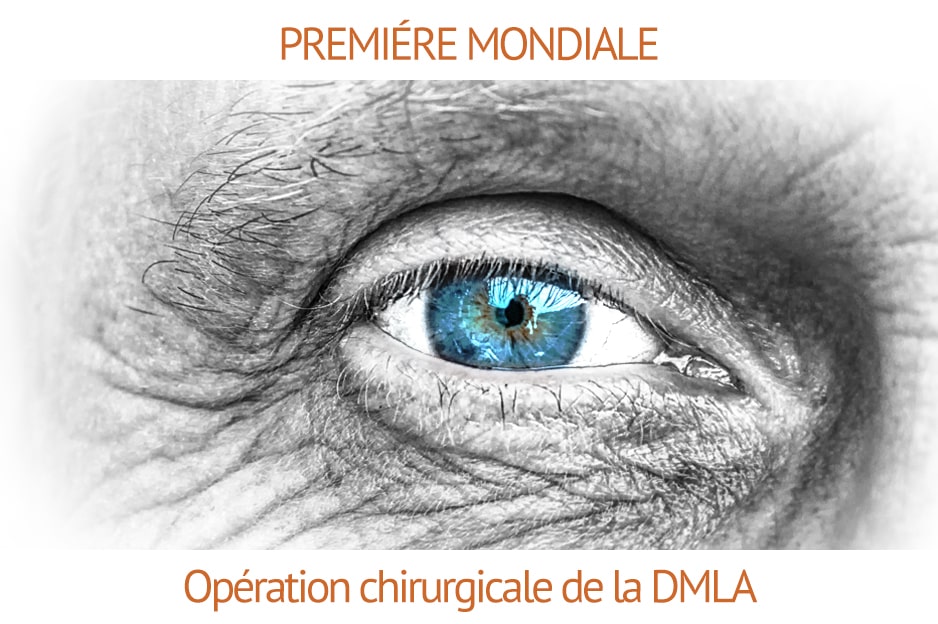 La chirurgie réfractive : Peut-on en mesurer les risques ? La chirurgie réfractive : Peut-on en mesurer les risques ?