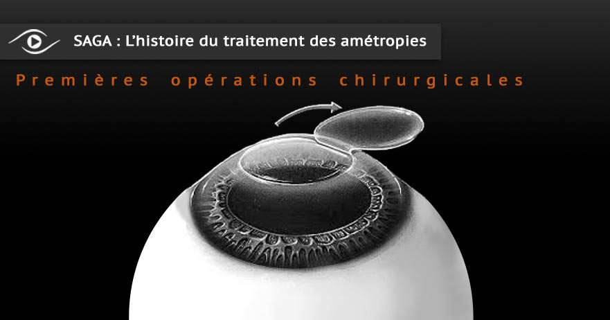 les connaissances ophtalmologiques et optiques du XXIéme siécle les connaissances ophtalmologiques et optiques du XXIéme siécle