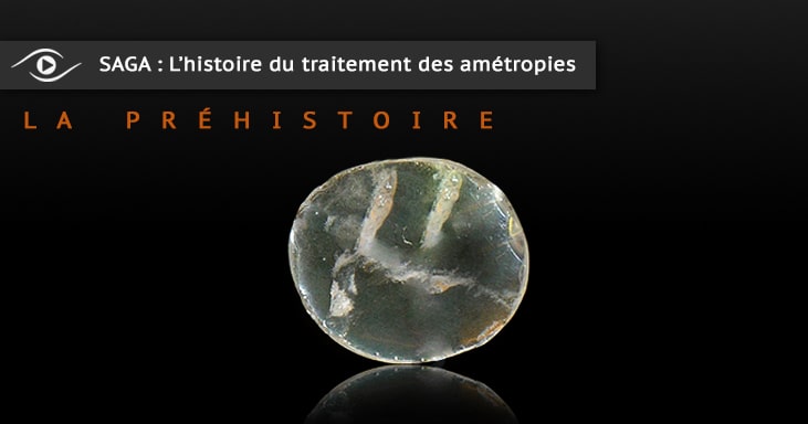 Le traitement des ametropies : La préhistoire Le traitement des ametropies : La préhistoire